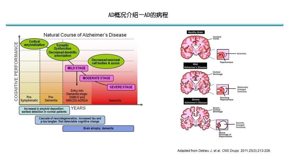 ad早期识别及诊治_第5页