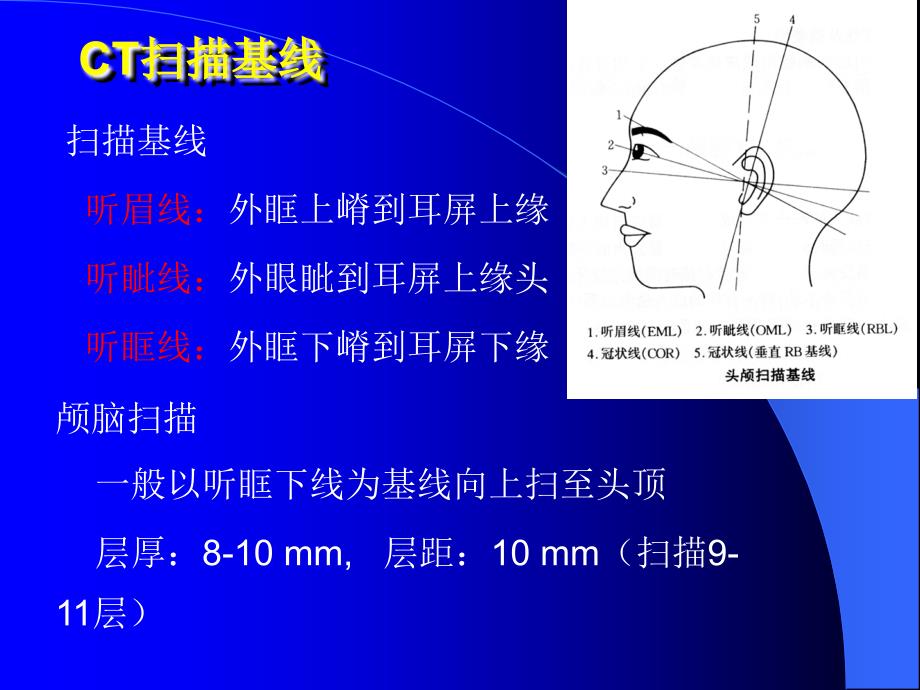 头颅ct精美课件_第4页