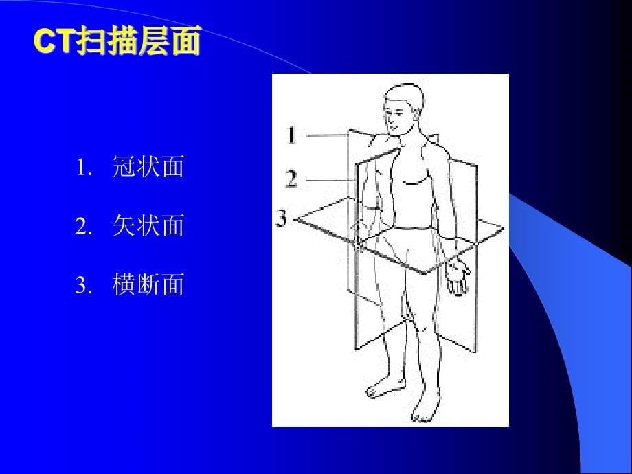 头颅ct精美课件_第5页