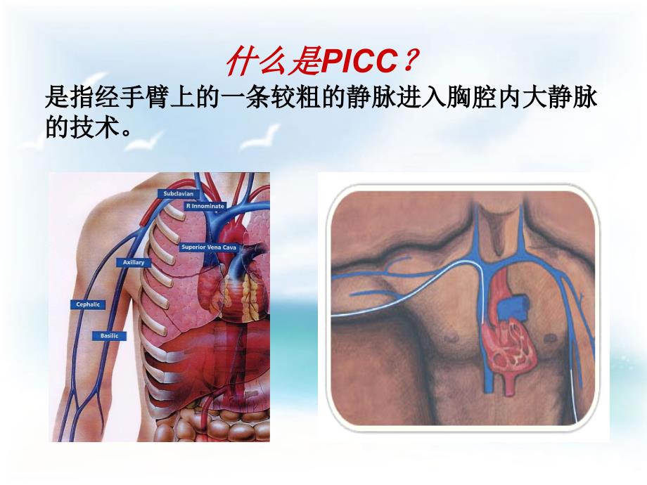 picc导管健康宣教新(3)_第4页