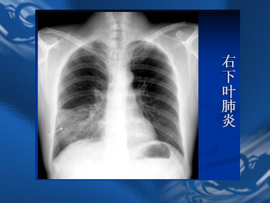 执业医师资格考试实践技能影像学辅导资料_第2页