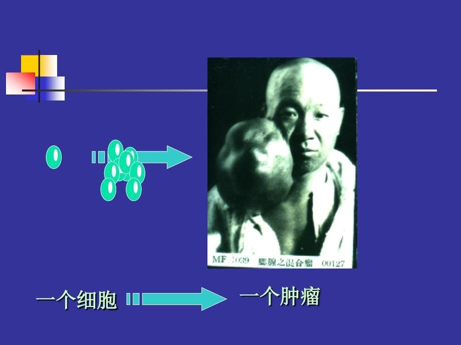 12年-04肿瘤(采用)_第5页