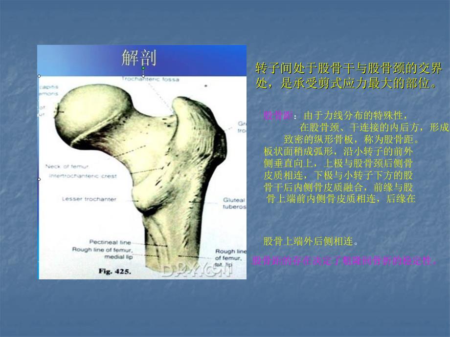 股骨转子间骨折分型、治疗_第4页