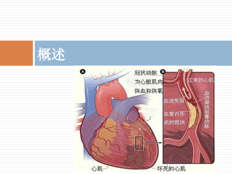 急性心肌梗死临床生化指标及检测方法_第2页