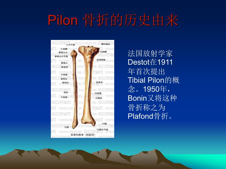 pilon骨折诊疗进展_第2页