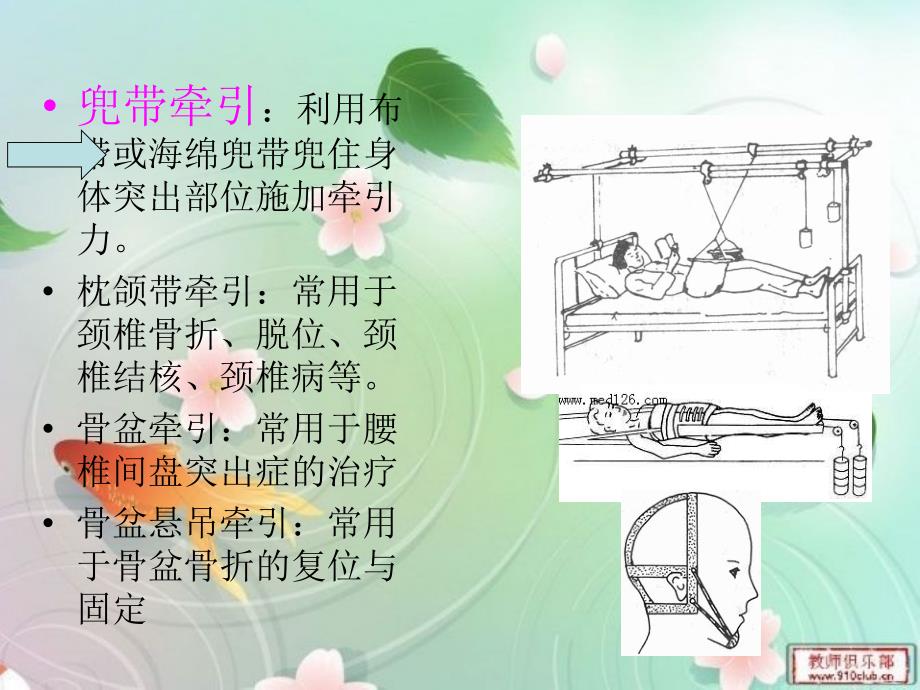 骨牵引和石膏固定术护理_第3页