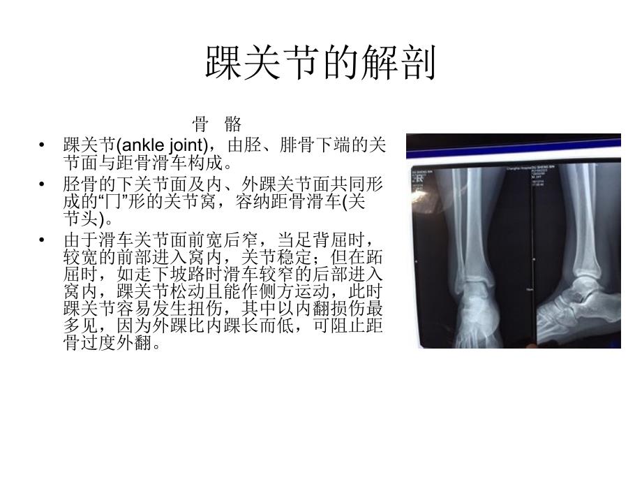 踝关节急慢性损伤治疗_第2页