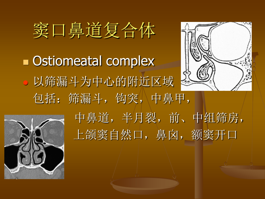 鼻窦解剖与变异ct表现_第4页