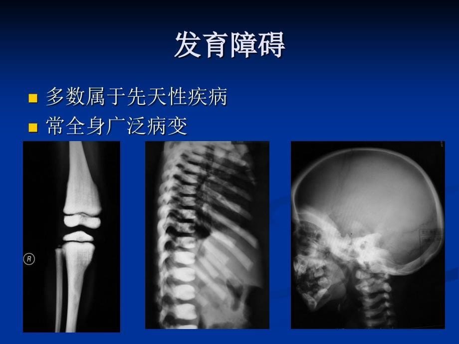 骨骼系统常见病影像诊断_第5页