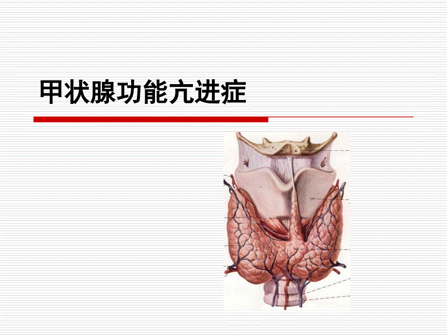 关于甲状腺功能亢进症ppt课件_第1页