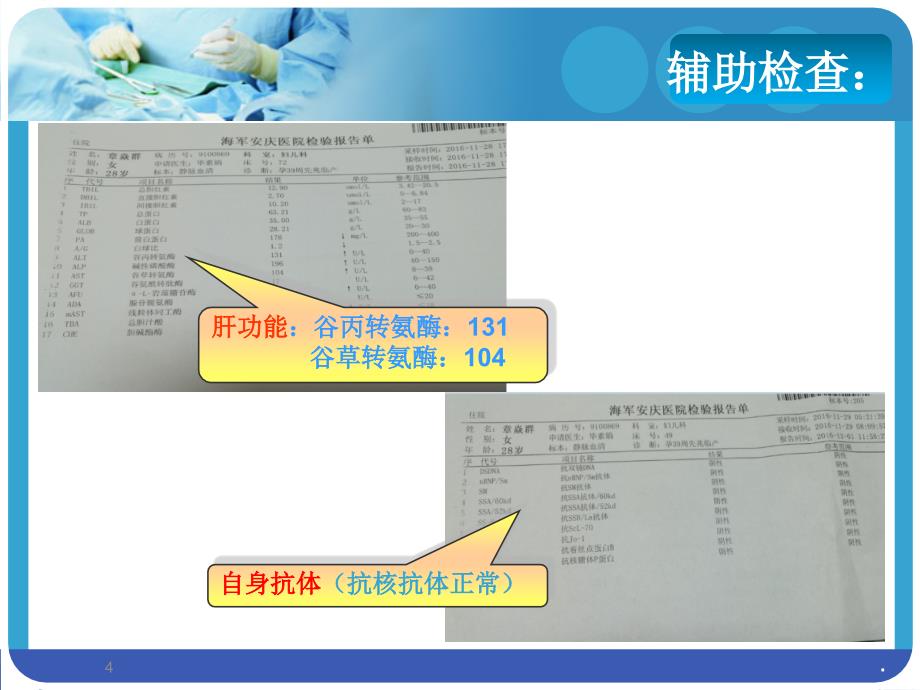 系统性红斑狼疮(sle)合并妊娠ppt课件_第4页