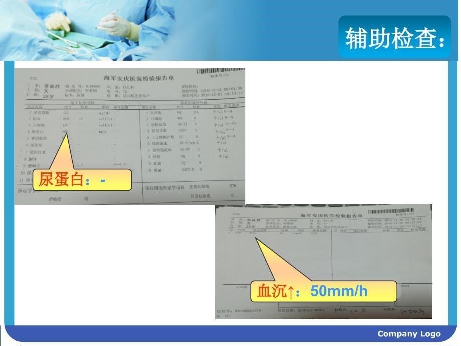 系统性红斑狼疮(sle)合并妊娠ppt课件_第5页