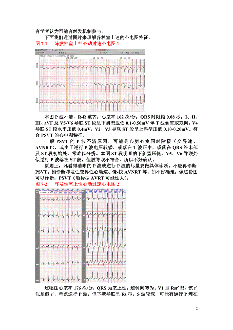 另类心电图讲义-7---室上性心动过速与折返性心律失常(1)_第2页