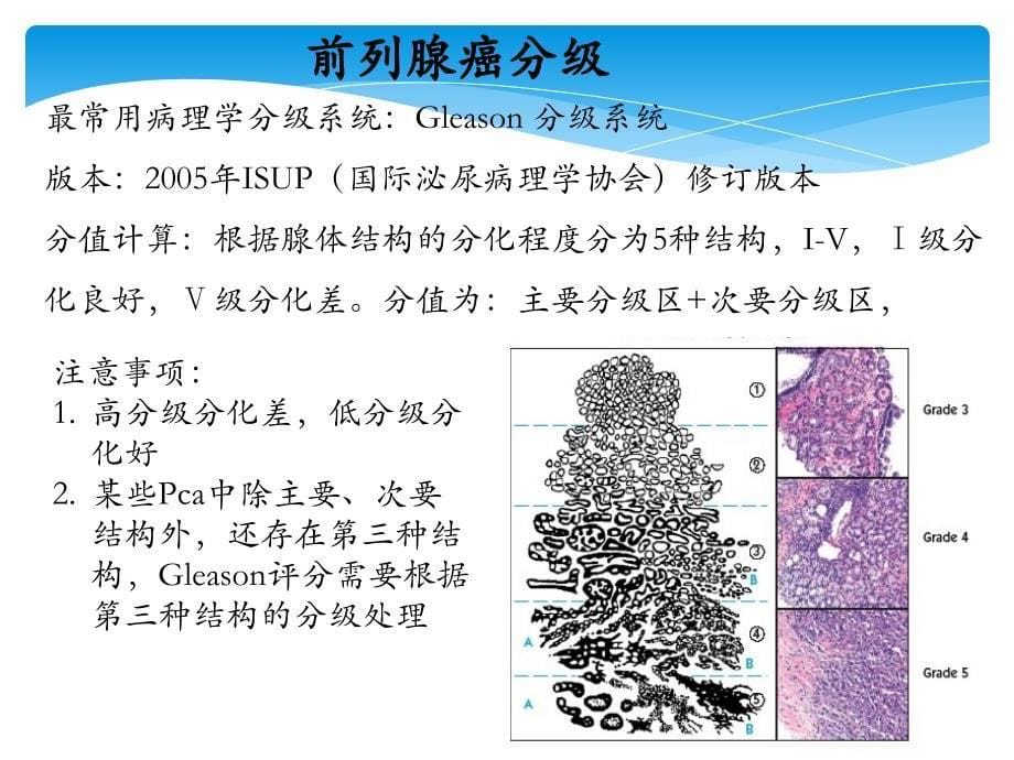 各期前列腺癌治疗指南推荐_第5页