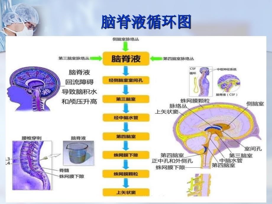 周喜良——脑室引流护理_第5页