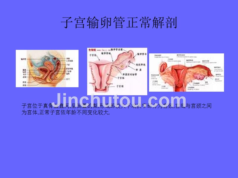 卵巢良性病变及子宫病变影像诊断_第4页