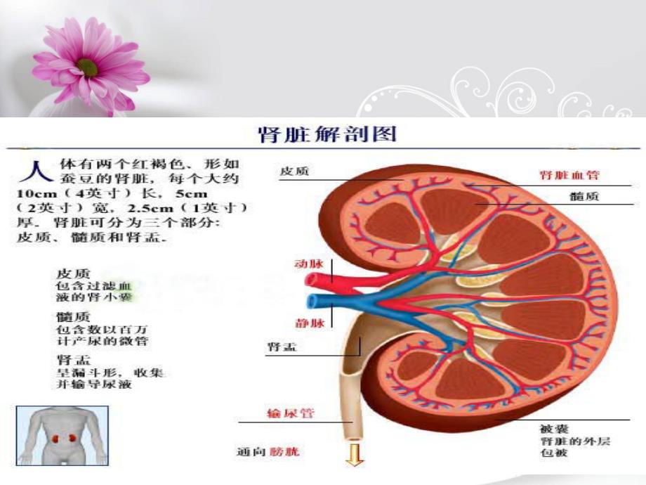 pcnl术肾结石护理_第2页