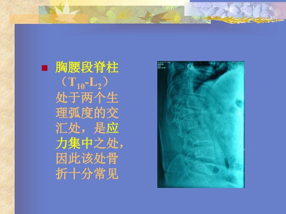 脊柱的稳定性及脊柱损伤的分类_第2页
