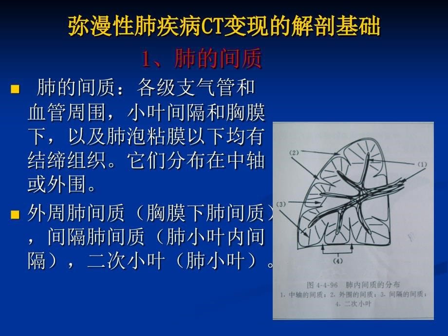 肺小叶、肺间质解剖与病变hrct诊断_第5页