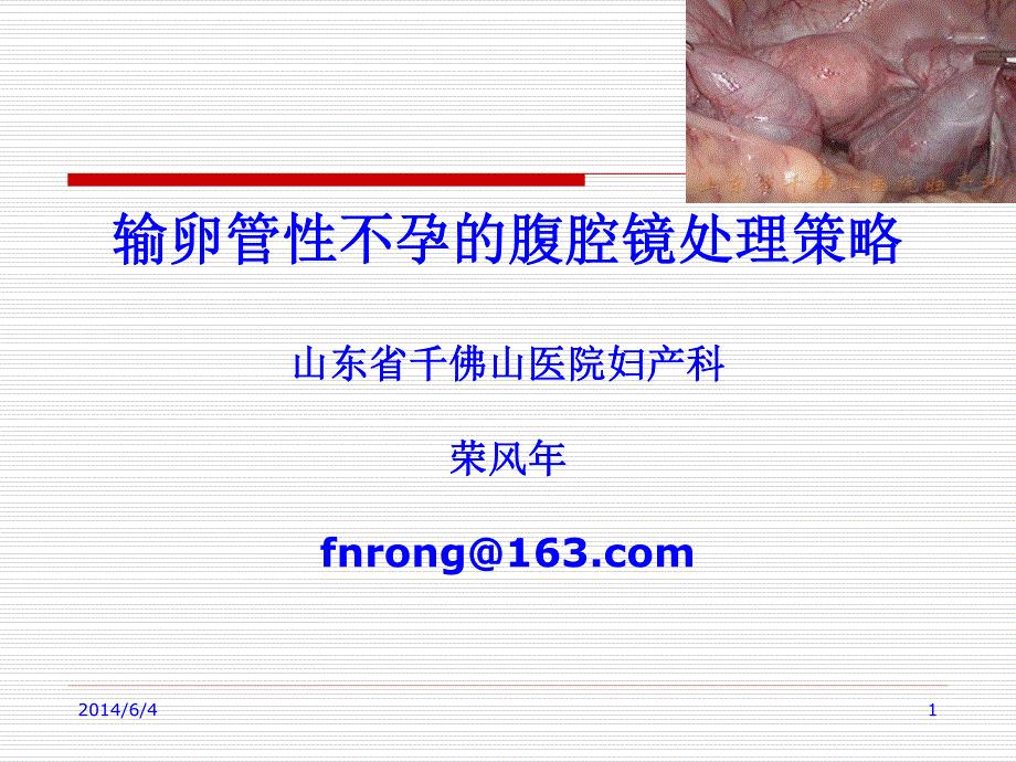 输卵管性不孕腹腔镜处理策略