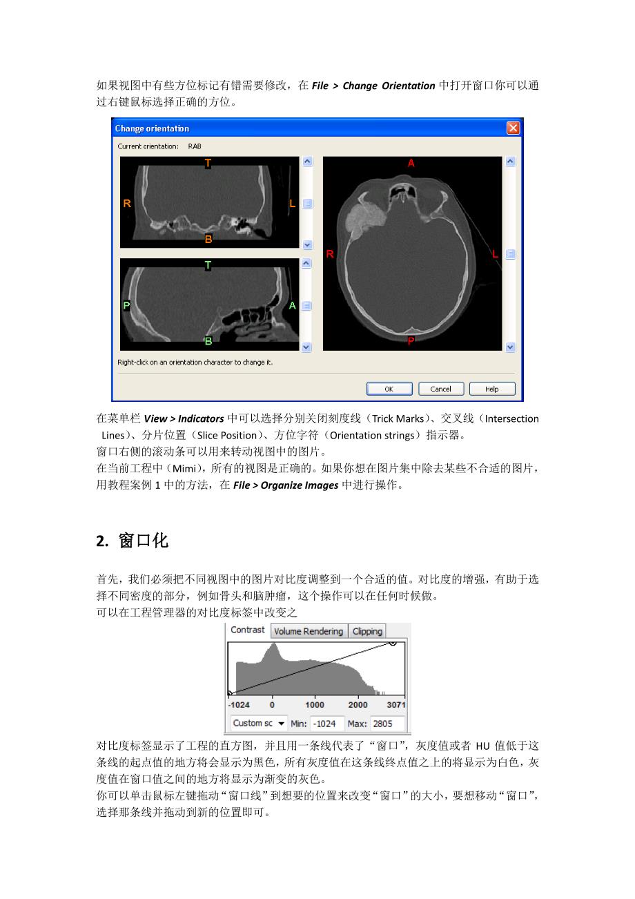 mimics中文版教程(持续更新版0812)_第2页