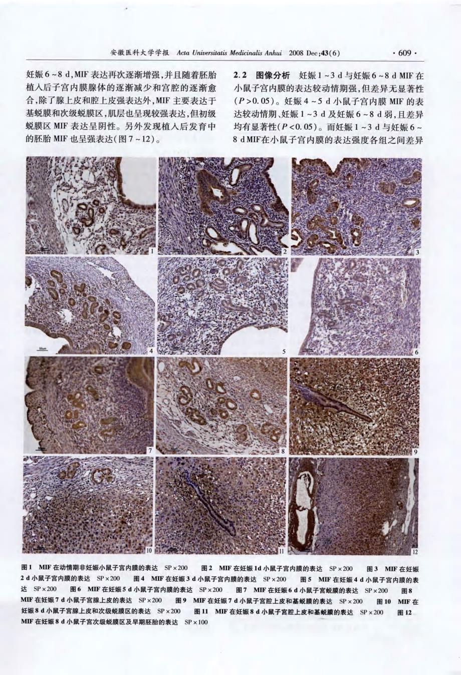 巨噬细胞移动抑制因子在围植入期小鼠子宫内膜中的表达_第2页