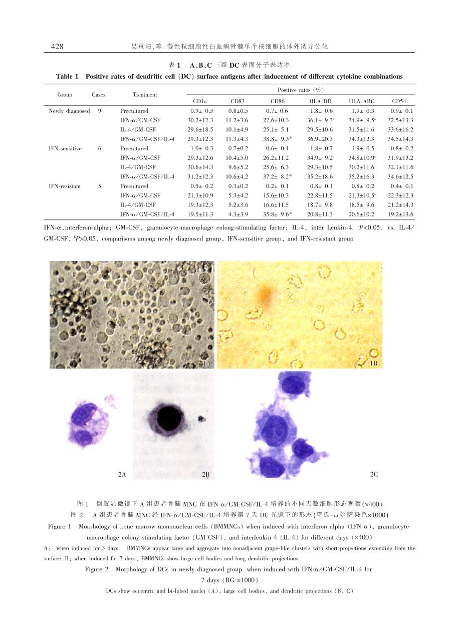 慢性粒细胞性白血病骨髓单个核细胞的体外诱导分化_第4页