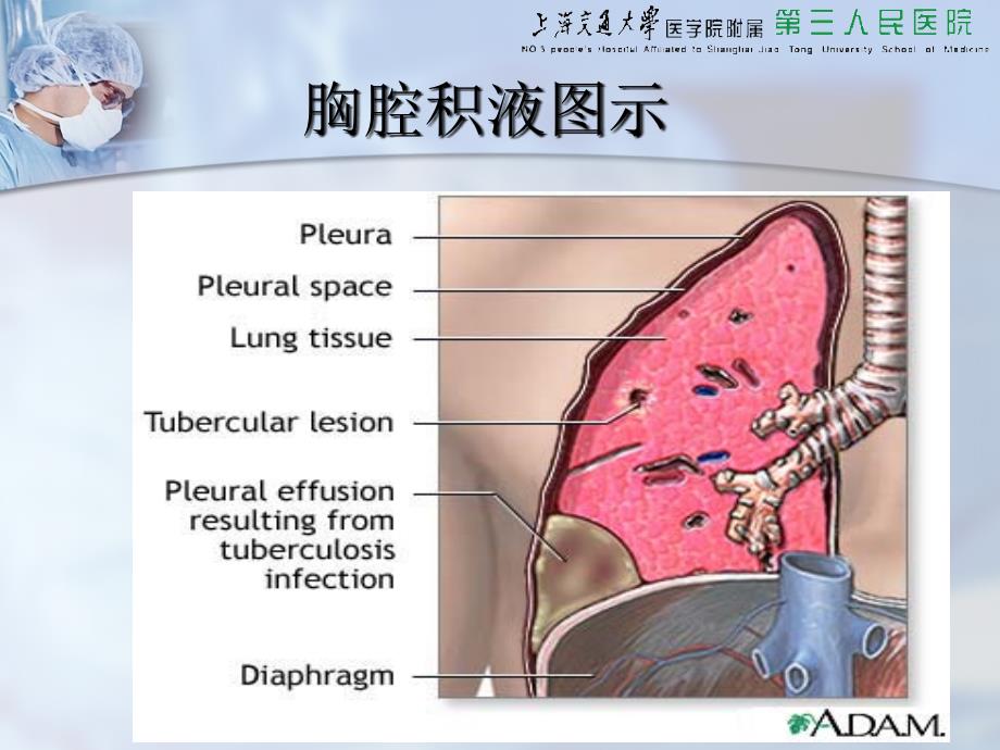 胸穿腹穿骨穿腰穿四大穿刺_第4页