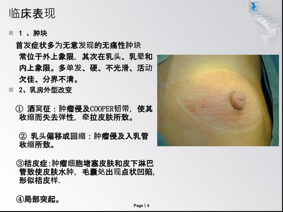 乳腺癌病因、临床表现、常见术式与护理要点_第4页