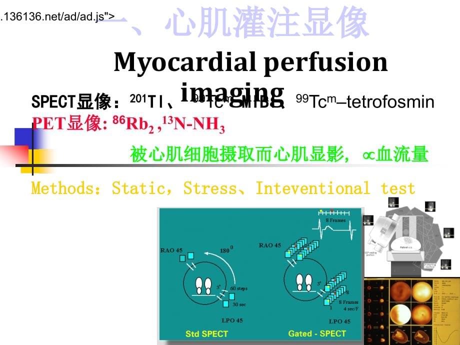 心脏核医学ppt课件_第5页