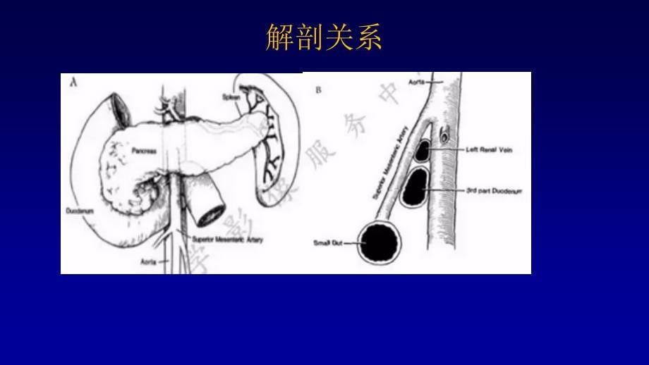 十二指肠淤滞症_第5页