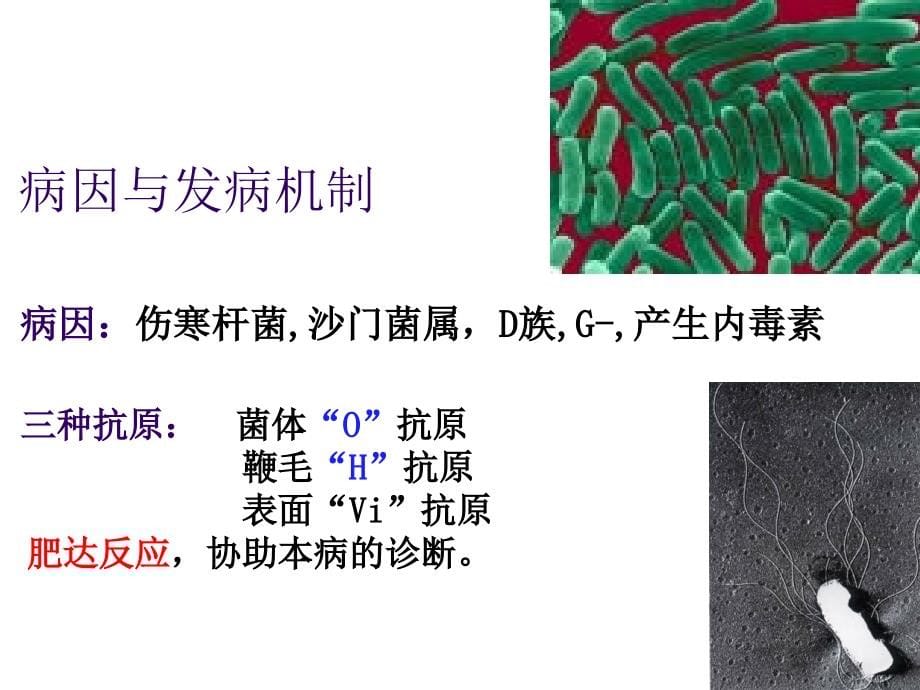 [病理学]传染病阿米巴病神经系统疾病_第5页