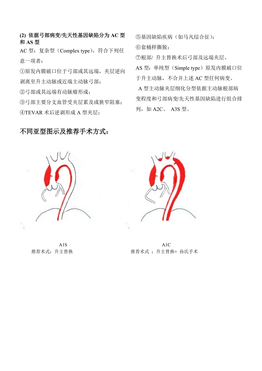 夹层分型与治疗方式_第2页