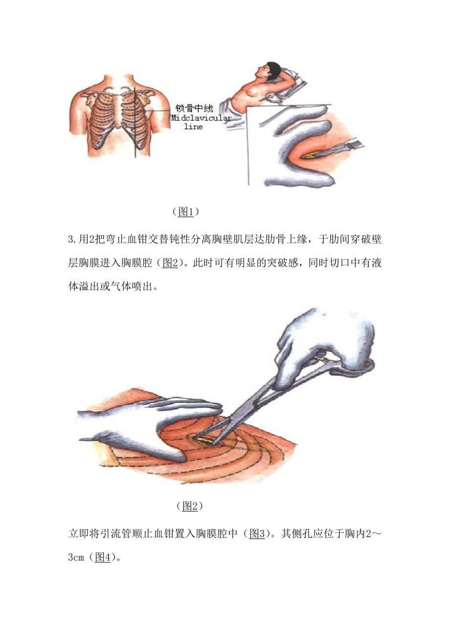 五种常用操作技术_第5页