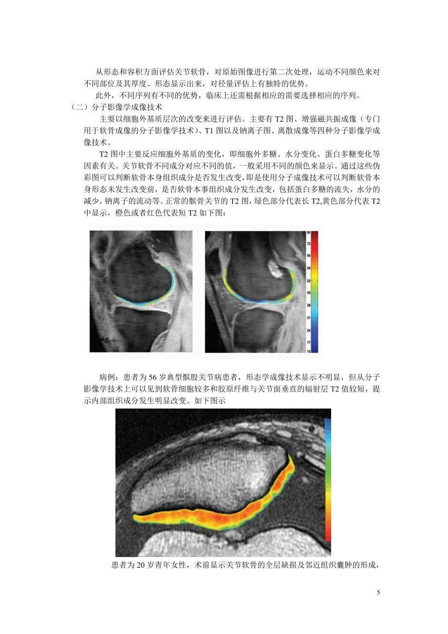 MRI对膝关节软骨损伤诊断_第5页