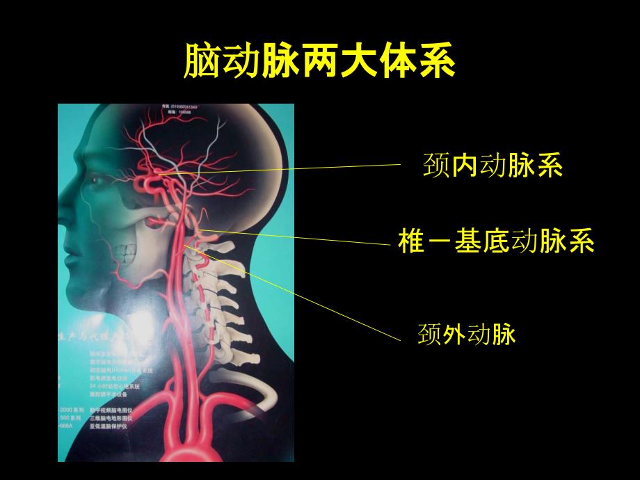 脑动脉正常变异_第4页