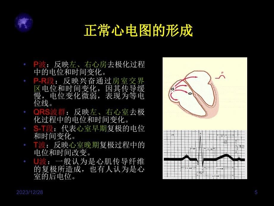 心电图入门精要.详解_第5页