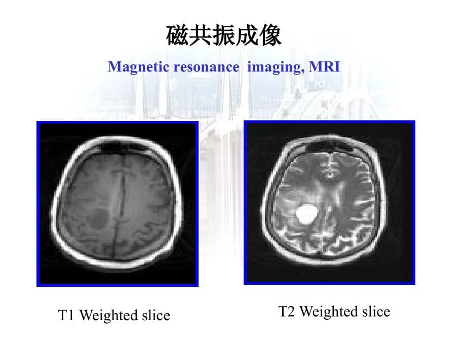 磁共振成像原理-_第5页