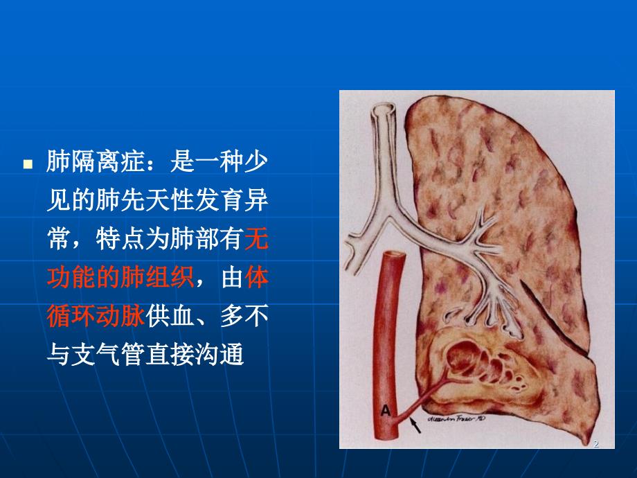 肺隔离症影像表现_第2页