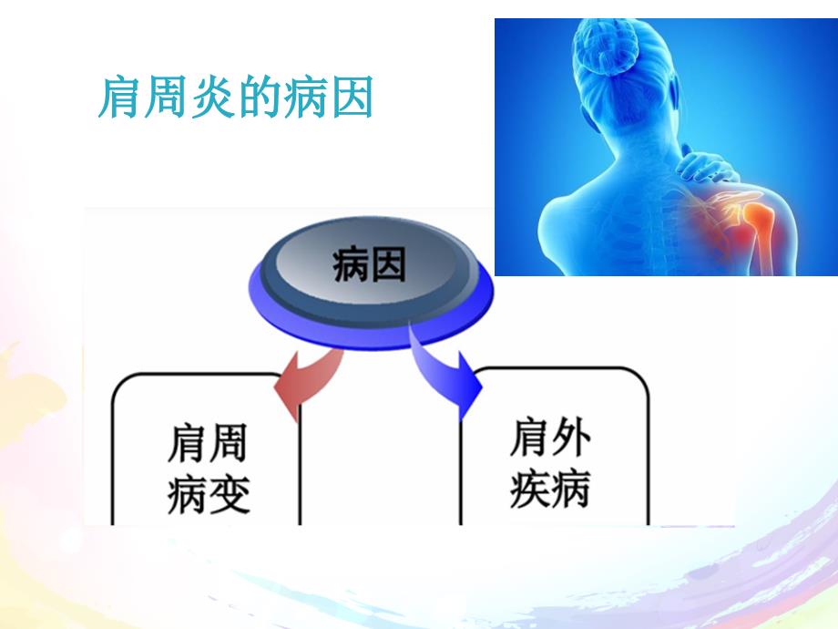 肩周炎治疗与护理_第4页