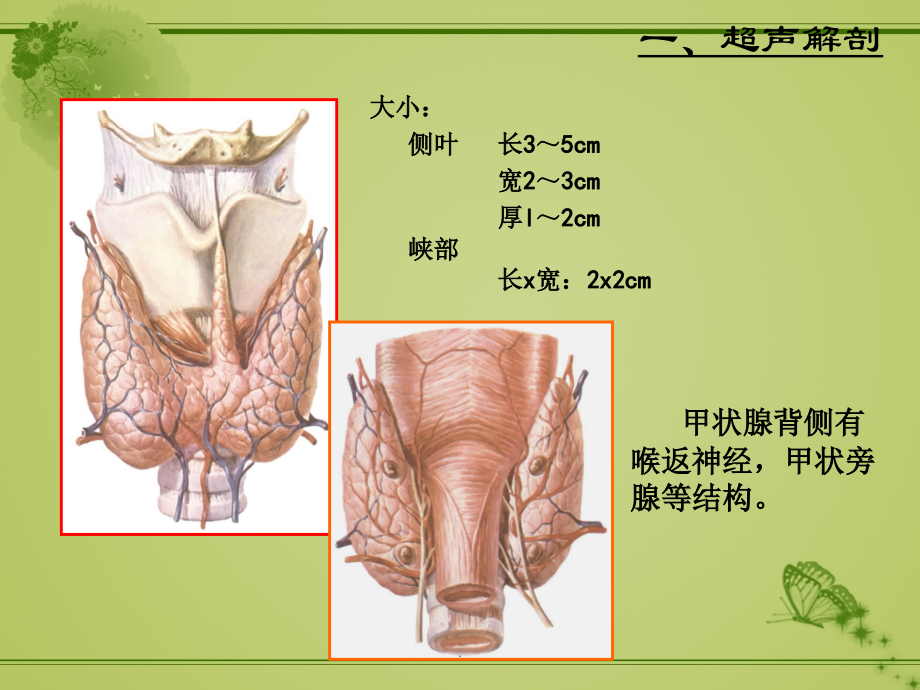 课件：甲状腺超声诊断_第4页