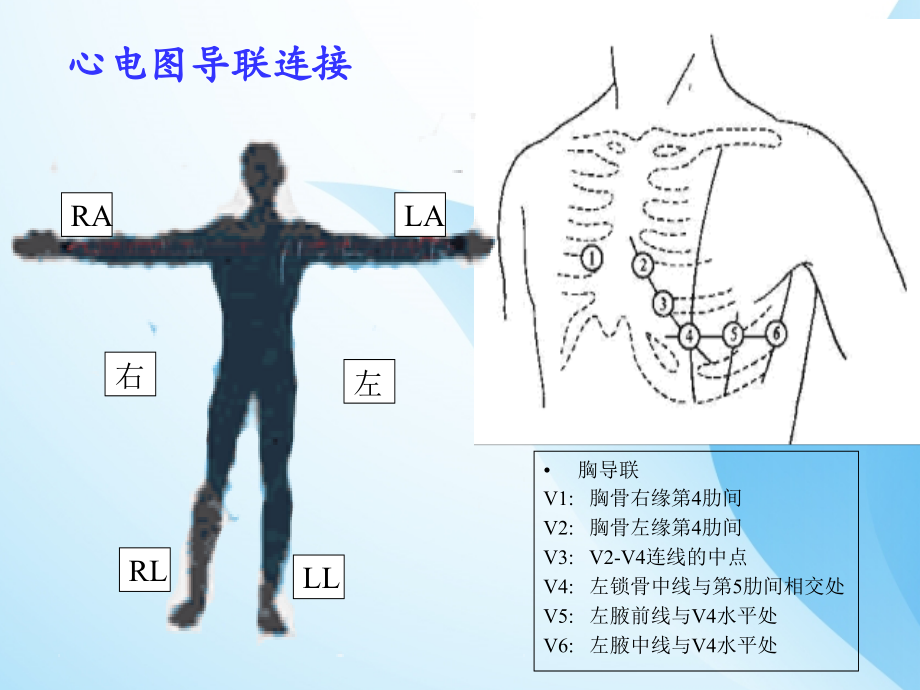 课件：临床心电图教学_第3页