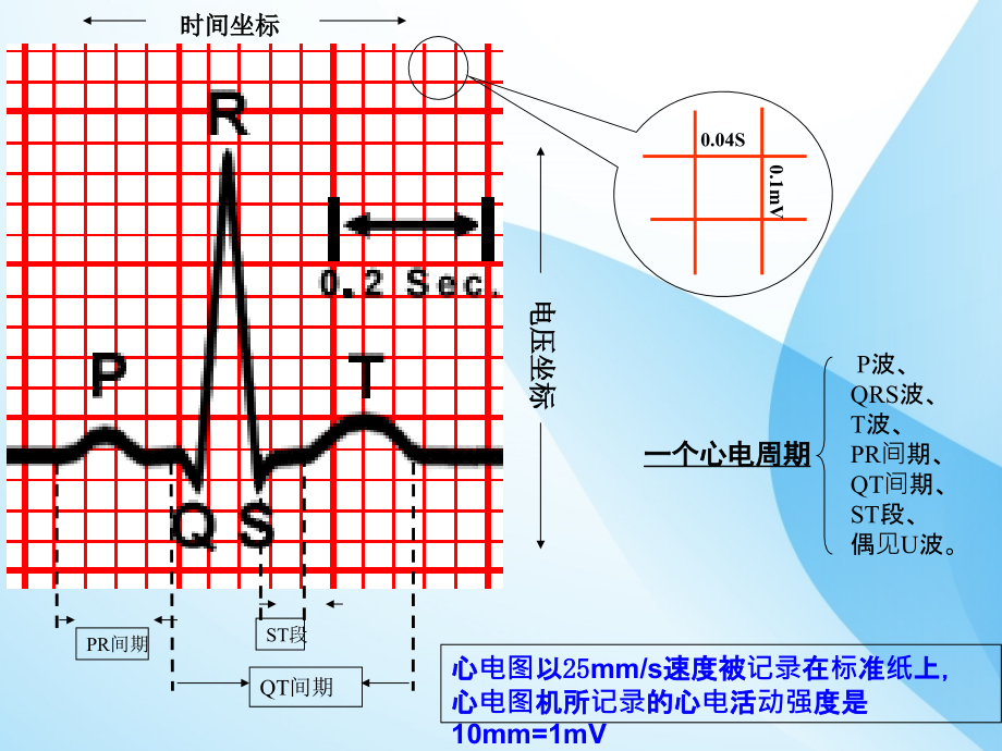 课件：临床心电图教学_第4页