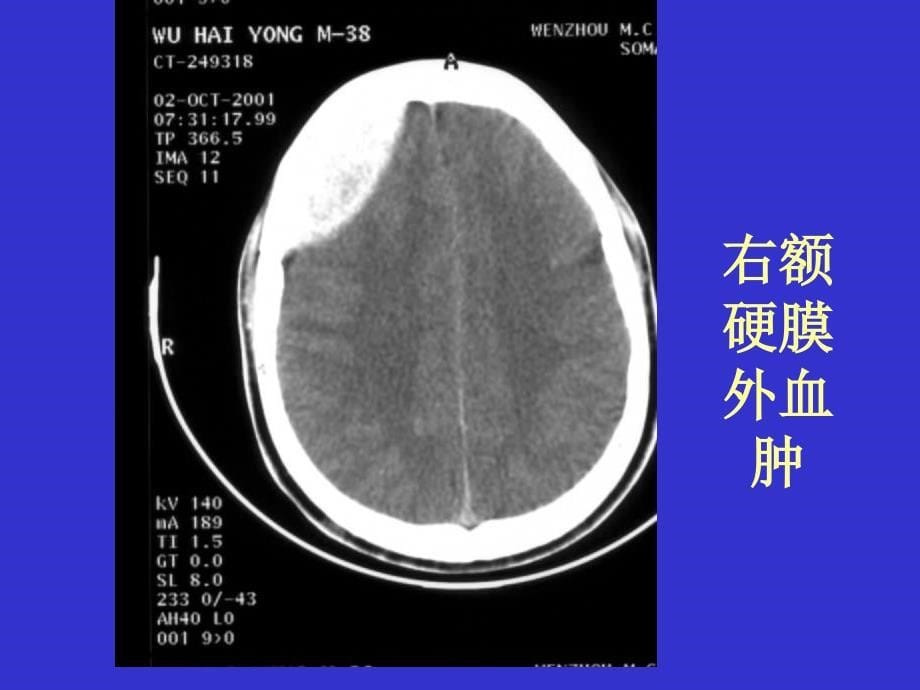 ct-实习片_第5页