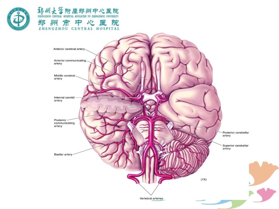 有关烟雾病幻灯片_第3页