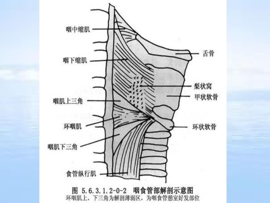 消化道憩室病详解_第5页