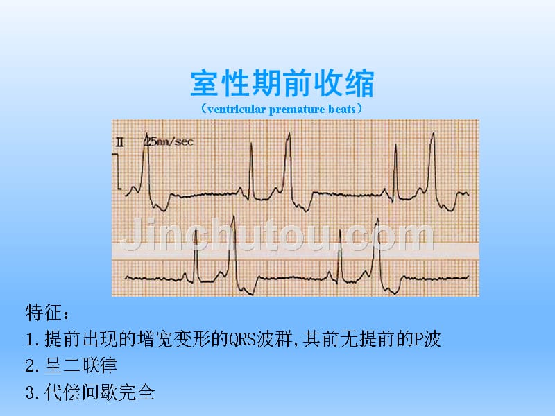 内科学——心律失常三_第3页