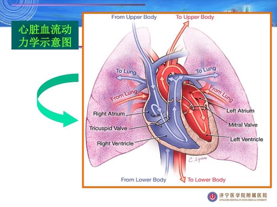 心脏瓣膜病 (3)_第5页