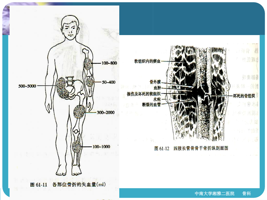 四肢骨折经典ppt_第3页