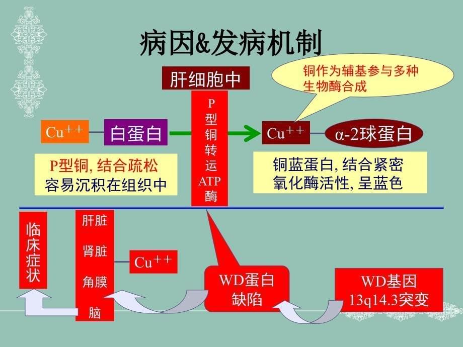 肝豆状核变性,讲课ppt_第5页